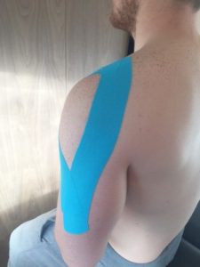 Kinesiology Taping Brookmans Park Osteopaths