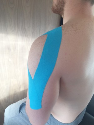 Kinesiology Taping Brookmans Park Osteopaths