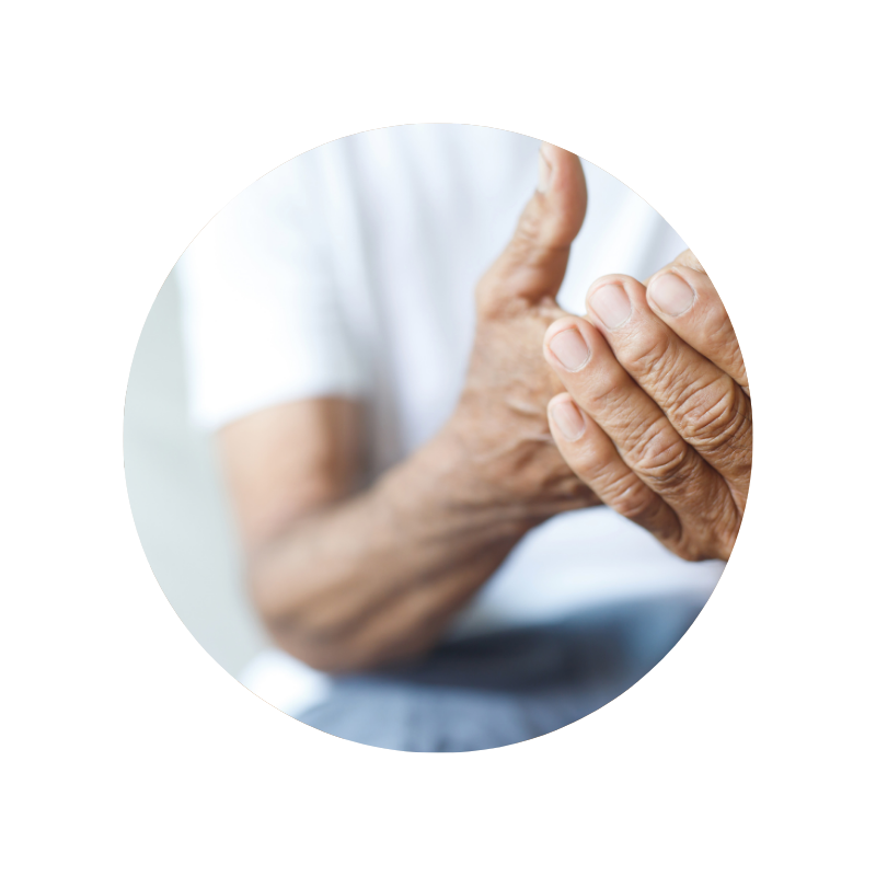 Osteoarthritis Treatment Hatfield